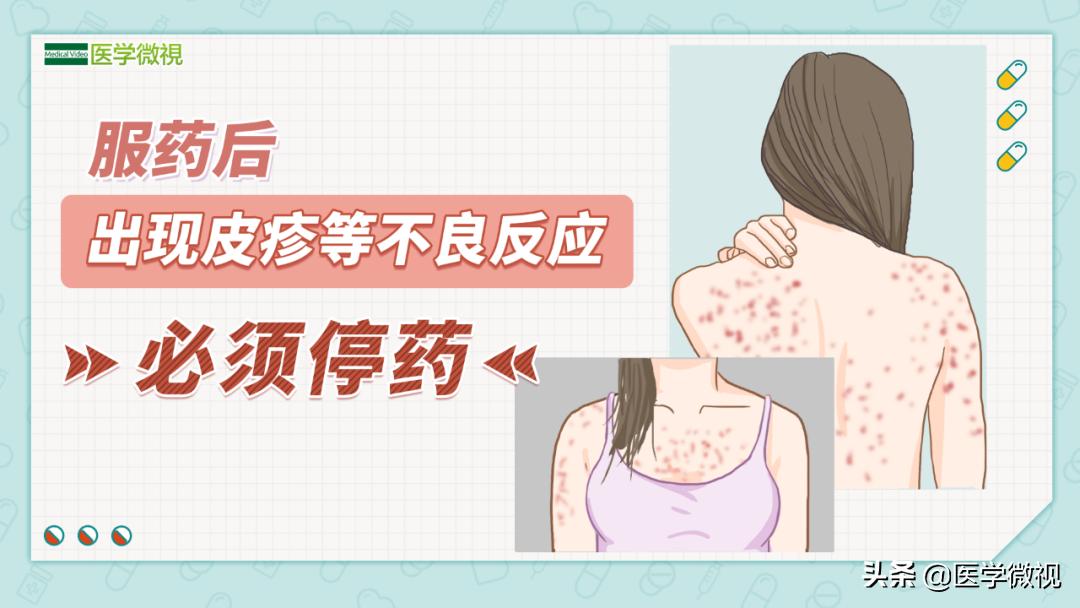 胃肠药如何起作用,胃肠药有什么效果吗