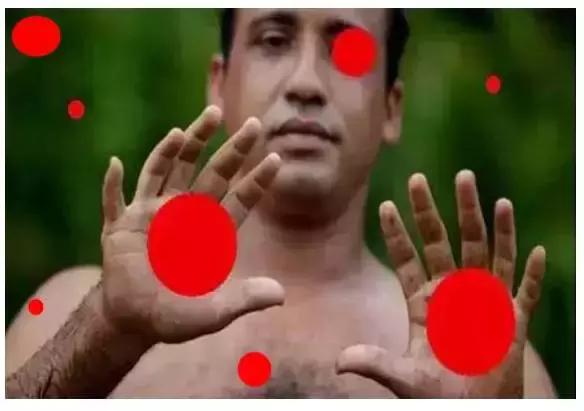 康复界名言,康复就是治愈疾病这个说法正确吗