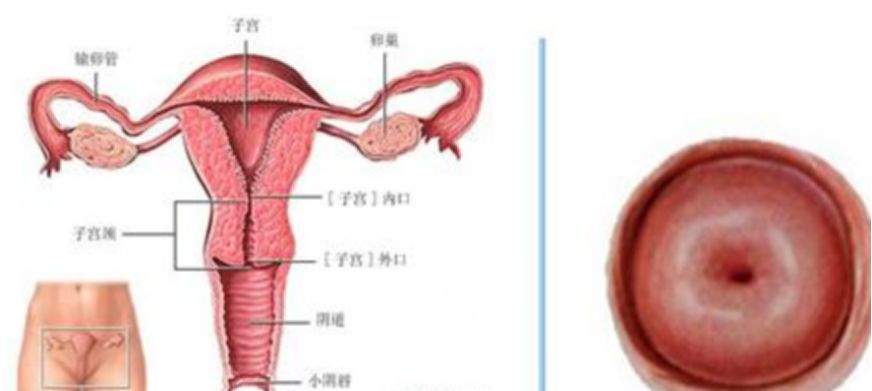 为什么得了宫颈炎没有症状,得了慢性宫颈炎不来月经怎么办