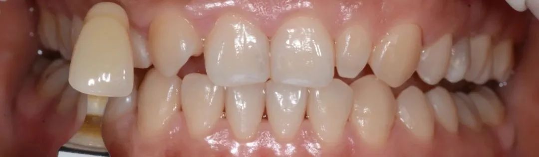 美白牙膏去牙黄真实有效测评,美白牙膏真实测评护牙效果