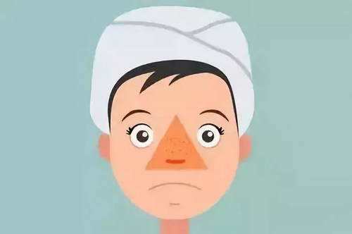 论挤痘痘,黑头去除方法挤痘痘