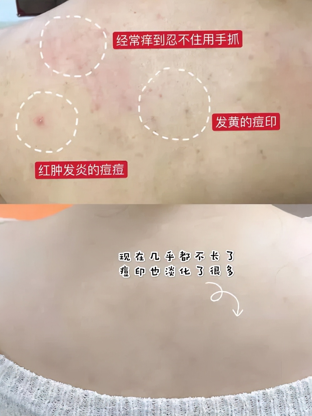 珀婷pertine除螨仪,珀婷除螨喷雾剂测评