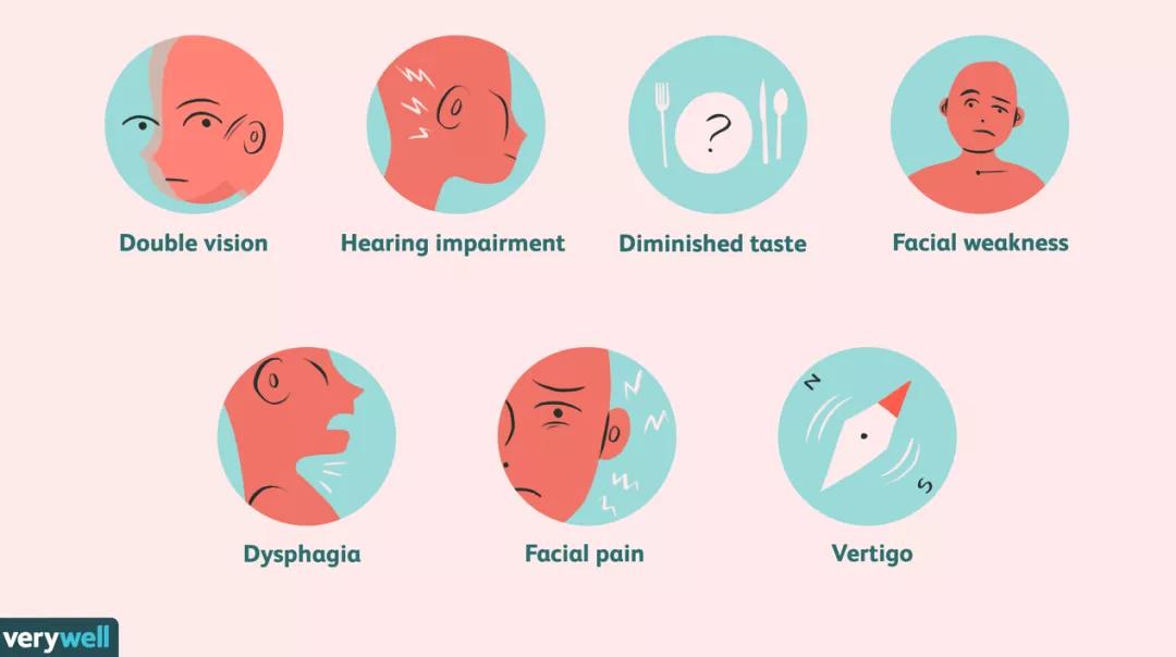 一级脑干胶质瘤,脑干胶质瘤指南
