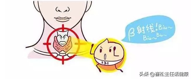 放疗的射线是怎么治疗癌的,放疗射线是治癌还是致癌