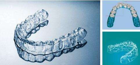 牙齿矫正后反弹了最好挽救办法,牙齿矫正反弹二次矫正收费