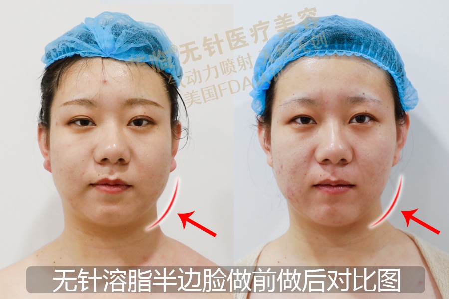 逆天侧颜女,逆天绝世容颜