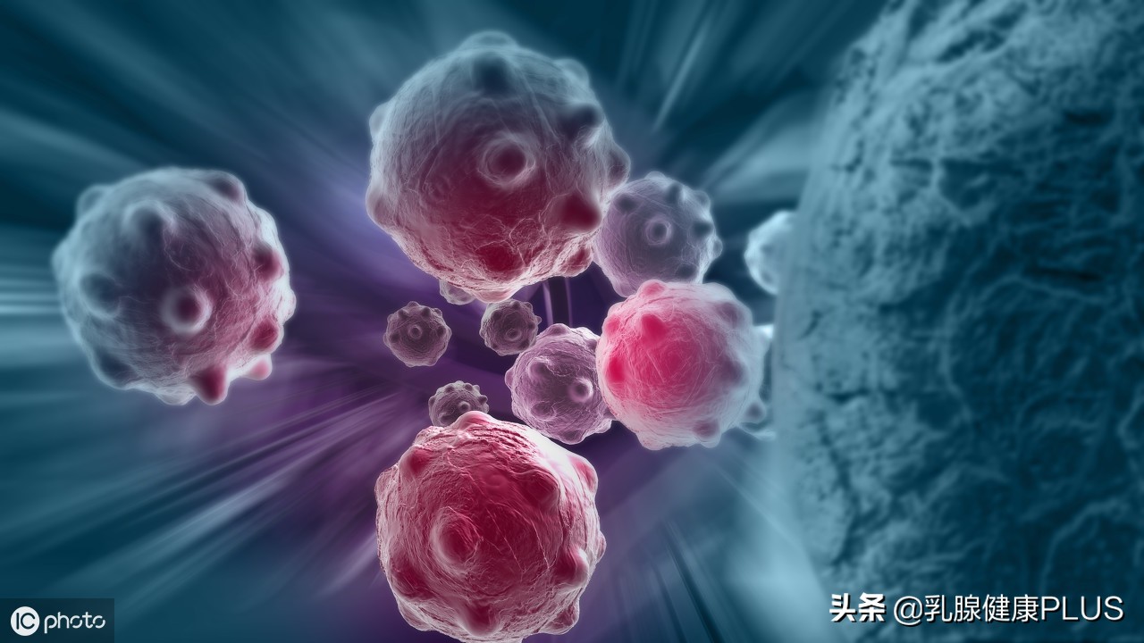 抗击乳腺癌23年成功案例,抗乳腺癌经历完整版