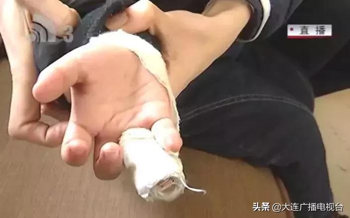 孩子在幼儿园被烫伤赔偿800万,小孩店里玩耍被烫伤谁担责