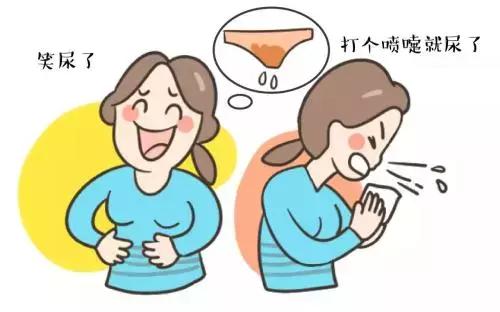 生完孩子一笑就漏尿,产后一笑漏尿