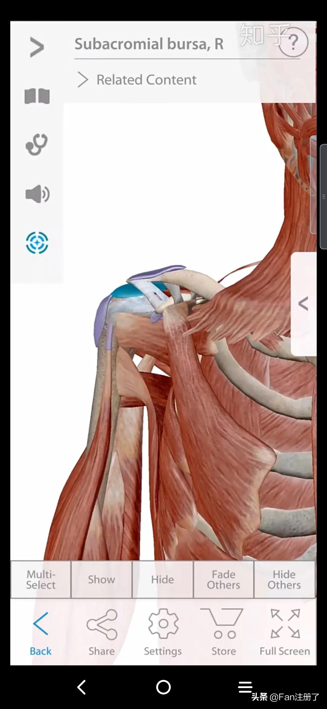 肩痛肩袖损伤针刀治疗,肩痛肩关节活动受限用什么药