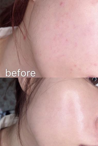 欧阳娜娜随手晒的面膜，一周卖出3万盒，网友：用完肌肤白里透红