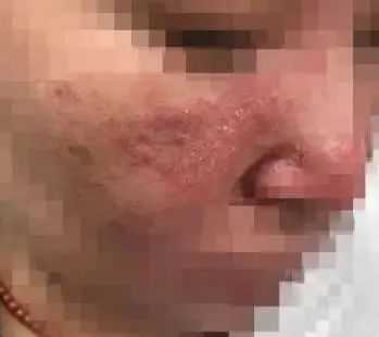 被整容毁掉女明星,被整容毁掉的中国女明星