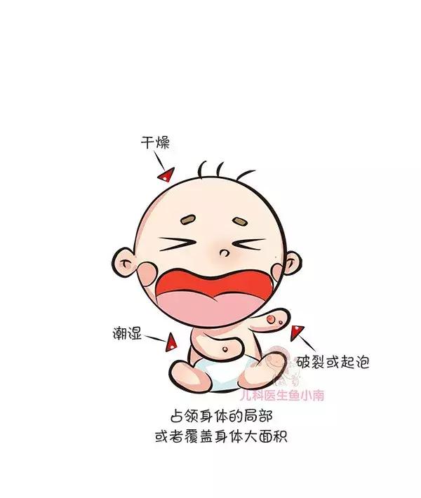 荨麻疹湿疹发病原因及治疗方法,热疹皮疹湿疹有什么区别