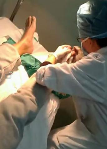 甲沟炎自愈的经历,甲沟炎的亲身经历