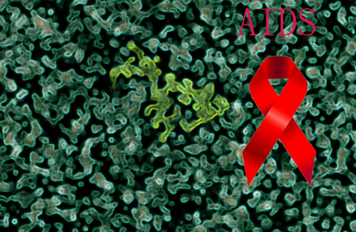 错把艾滋病当皮肤病,别错把艾滋当成皮肤病