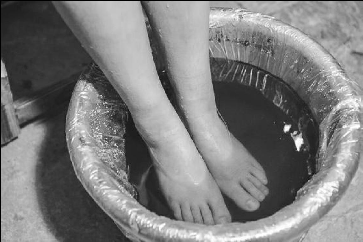 中医治疗类风湿性关节炎中成药,类风湿关节炎中医西医结合方案