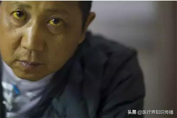 怎样看懂乙肝大三阳肝功能化验单,教大家如何看懂肝功能化验单