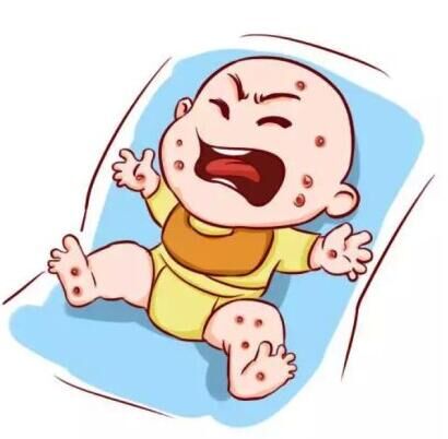 湿疹好了多长时间不用忌口,慢性湿疹不用激素药能治好吗