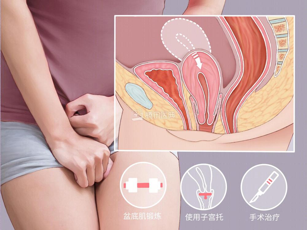 医生会把子宫拽出来吗,医生把子宫切除
