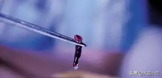 3岁男童肚子有虫怎么办,3岁男孩肚子里有虫子