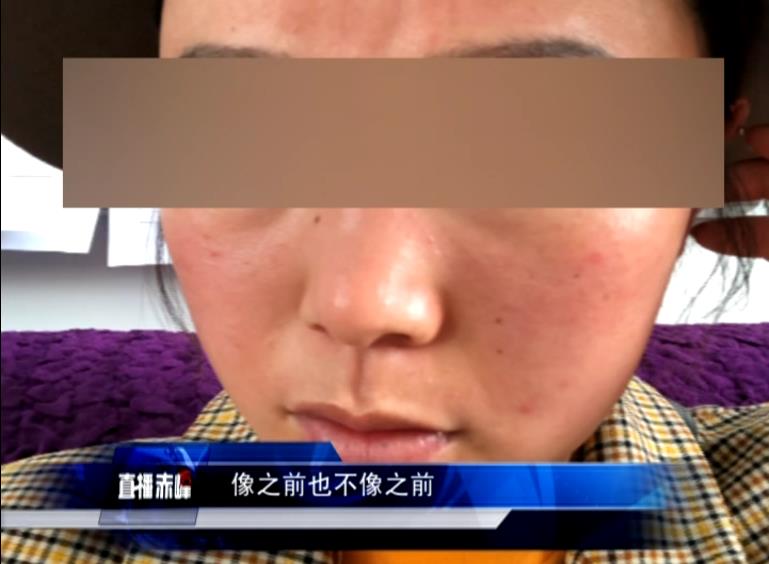 爱美整容有错吗,整容手术失败爱美无错但需慎重