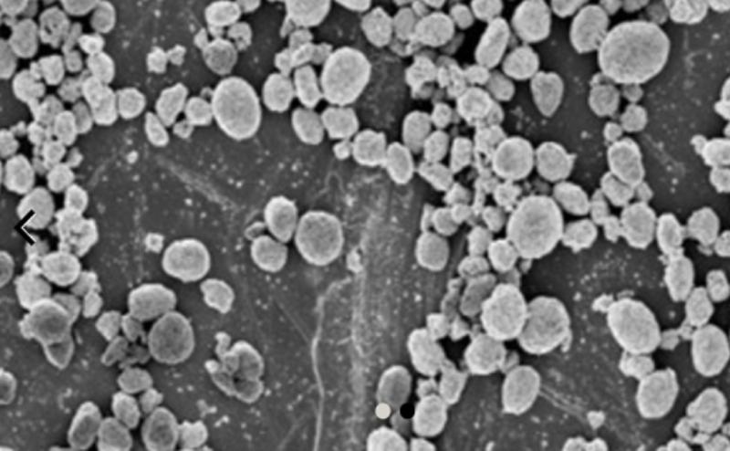 牙膏里二氧化硅的用途有害吗,牙膏真的可以消掉手机划痕吗