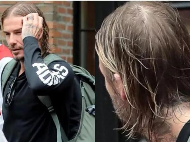 威廉王子秃顶了哈里为啥没秃顶,威廉王子为什么喜欢秃顶