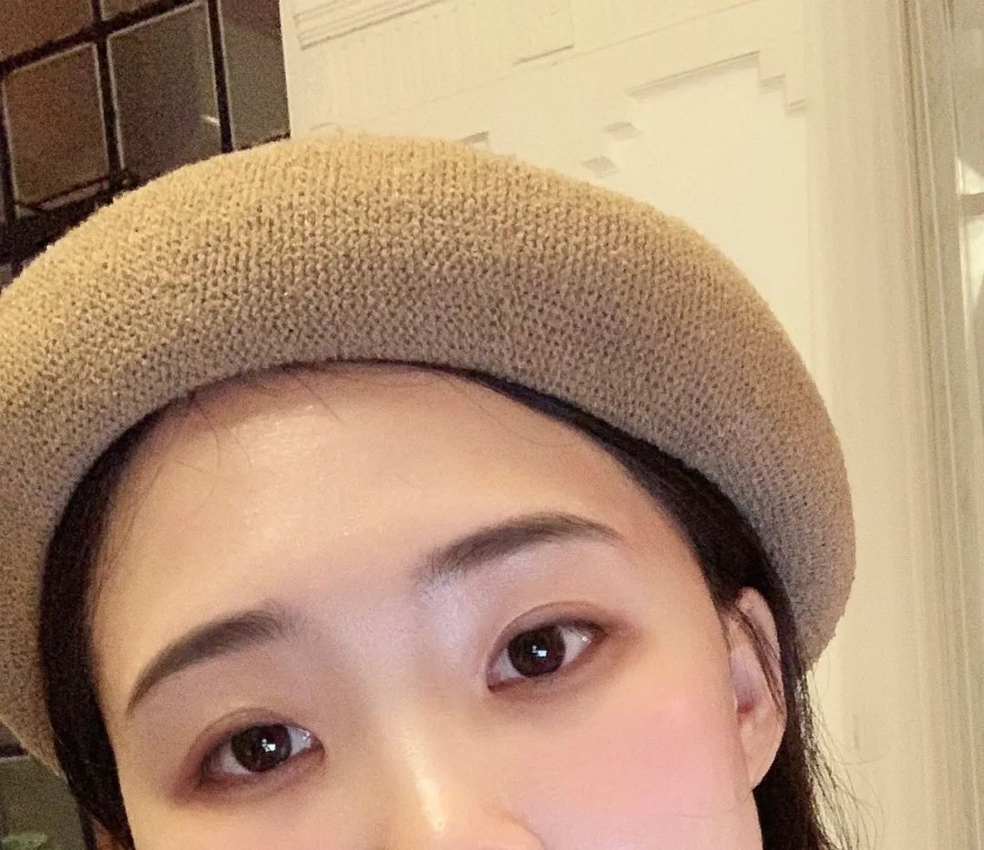 头型尖怎么整容,头型太丑什么发型能补救