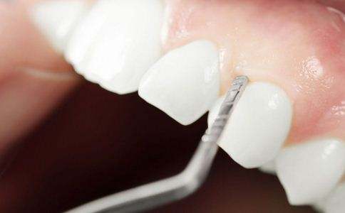 牙周炎为什么会引起牙齿松动,牙龈肿胀牙齿松动的原因牙周炎