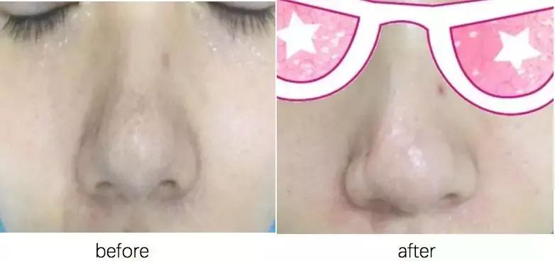 灏忕櫧涔熻兘闂溂鍏ョ殑鍖荤編椤圭洰,鍖荤編涓殑绱犻缇庤倢椤圭洰