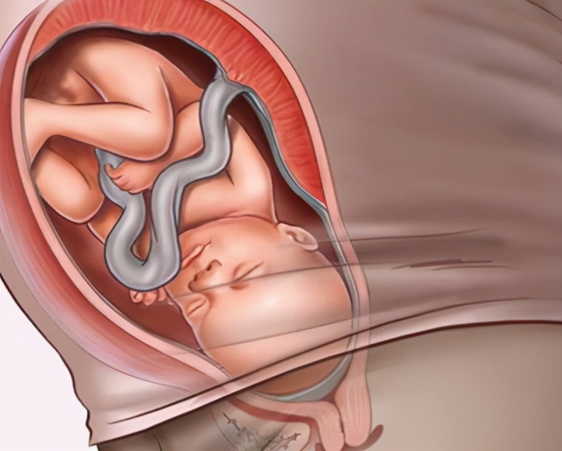 孕后期好害怕生产,孕后期担心胎儿健康