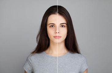 用了冻干粉会不会继续爆痘,揭秘冻干粉太可怕了千万不要再用