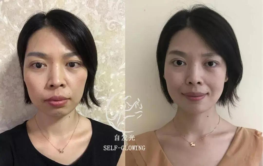 抗衰老预防垮脸,抗皱抗衰去细纹有哪些