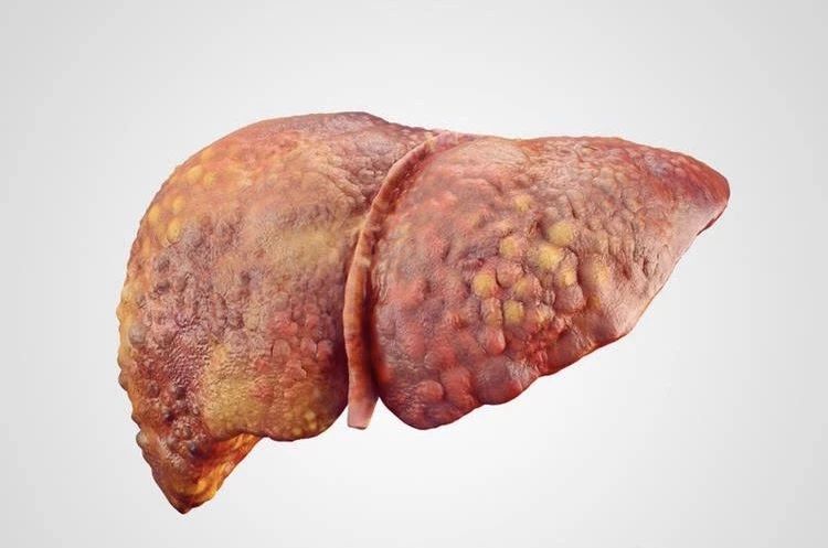 猫慢性肝炎早期几乎不能发觉，判断和预防猫慢性肝炎，应该这么做