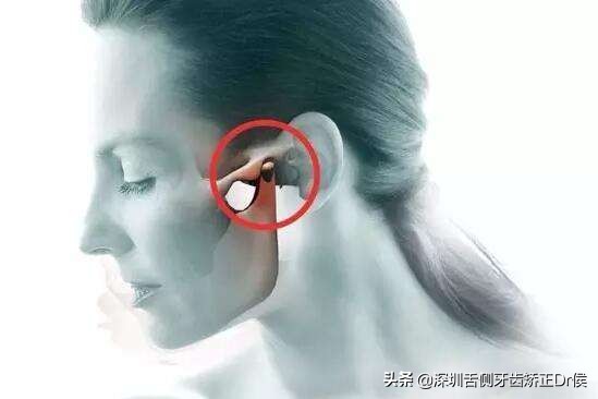 一边牙齿咬合咀嚼吞咽困难,咬合肌疼痛张嘴咀嚼就疼怎么办