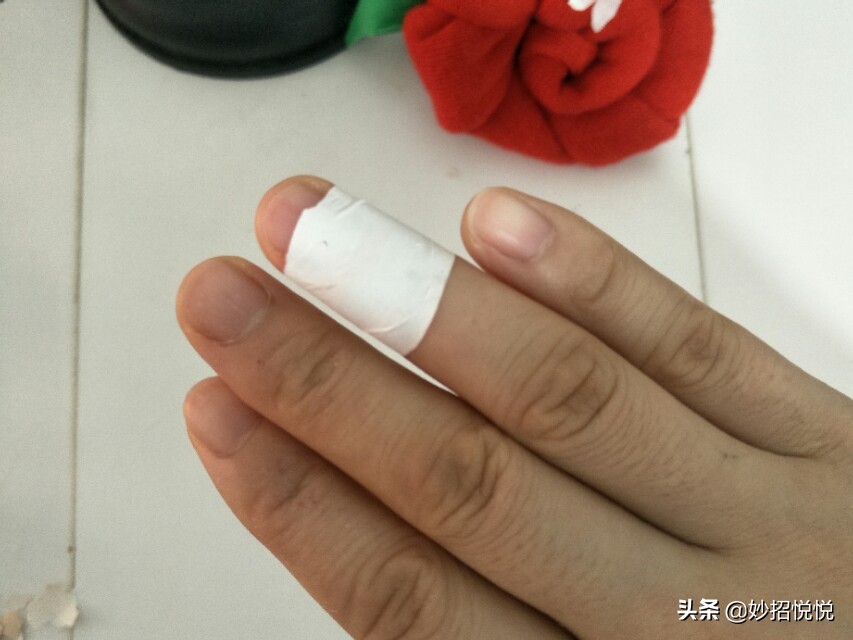 不知道被什么划伤的伤口怎么处理,被划破如何快速愈合