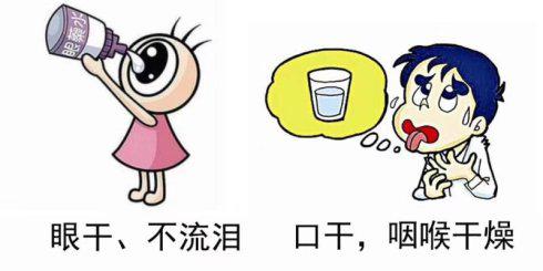 得了干燥综合症怎样用药,干燥综合征注意事项