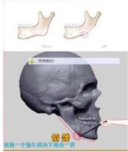 杨幂这些整容后遗症告诉你，不断返厂重修，代价得不偿失