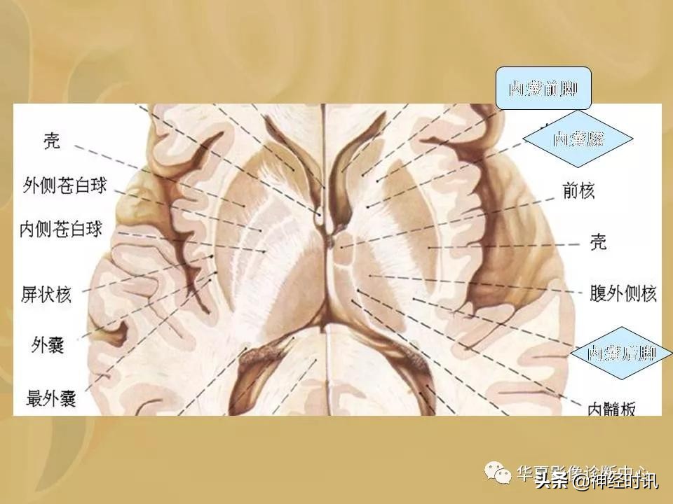 基底节ct解剖示意图,影像解剖图谱怎么用