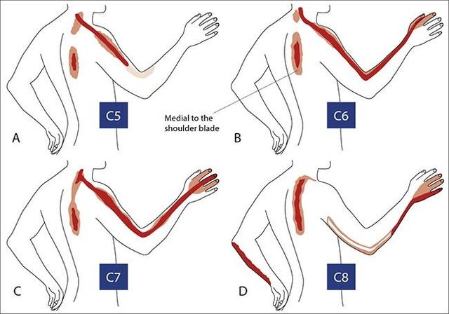 手麻是什么原因造成的怎样治疗,手麻是五种原因引起的要警惕