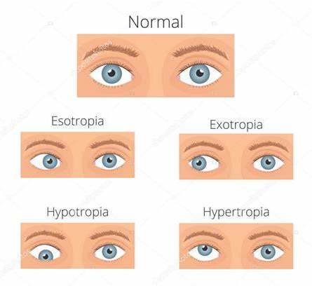 孩子总斜眼睛,孩子看电视头歪眼睛斜怎样矫正