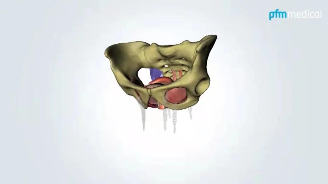 妇科盆底康复案例分享,女性盆底重建手术最好的医生