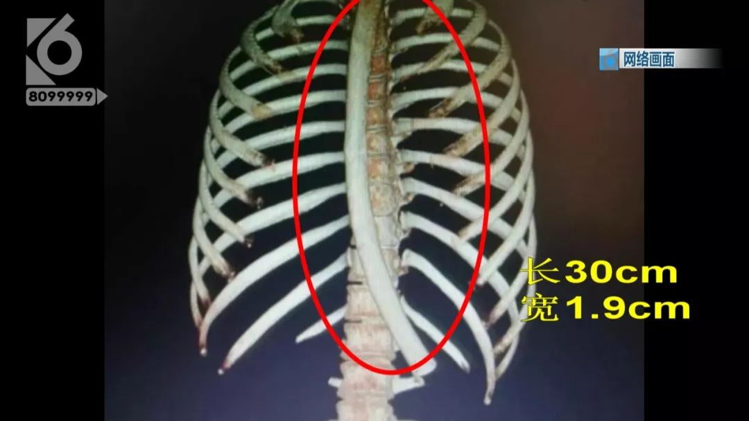 为了瘦就要放弃美食,为了瘦而丢掉性命