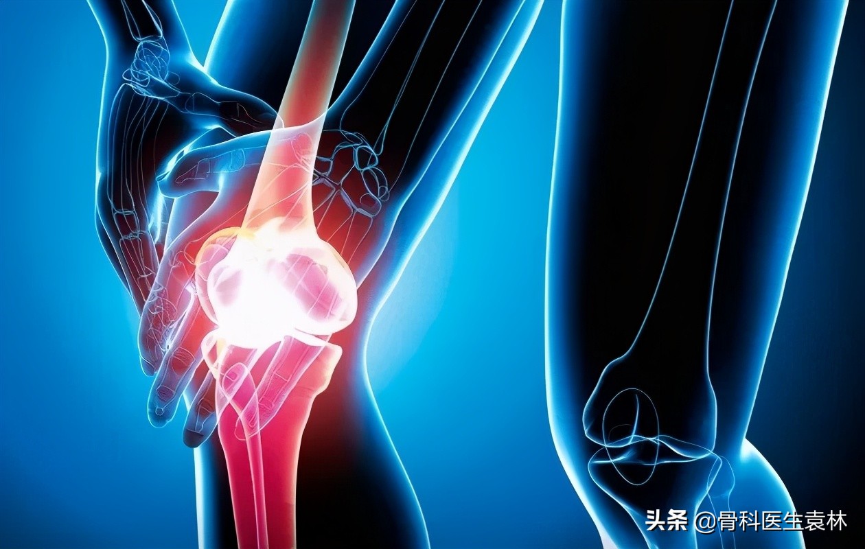 膝盖疼说是滑膜炎有什么膏药吗,膝盖疼说是滑膜炎怎么办