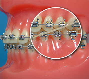 矫正科普15秒,科普矫正