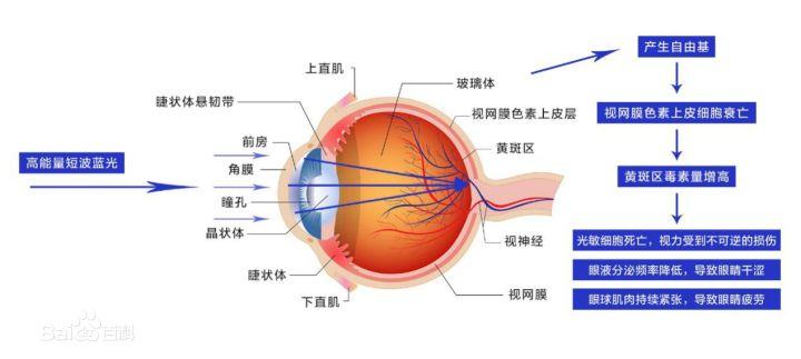 网上买眼镜怎么避免用假货,网购选眼镜的正确方法