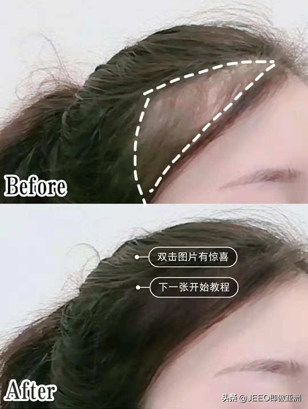 每日即傲一招——早晚5分钟生发防脱发