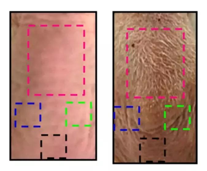 生发帽治疗效果,生发神药发明