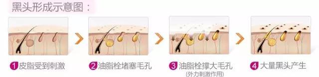 牙膏去黑头的方法靠谱吗,牙膏去黑头的正确方法