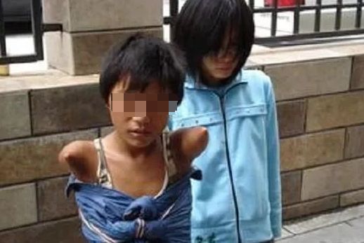 眼球被挖走了还能恢复吗,眼球被挖了还会活着吗